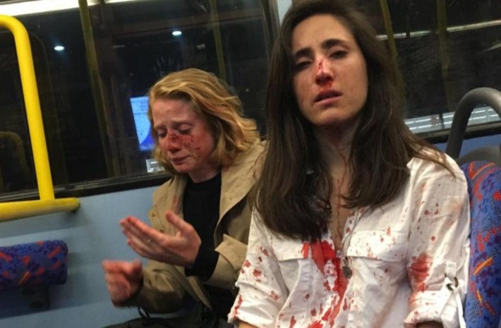 
<span>El valiente y emotivo mensaje de la pareja de lesbianas agredida en el autobús en Londres</span>
