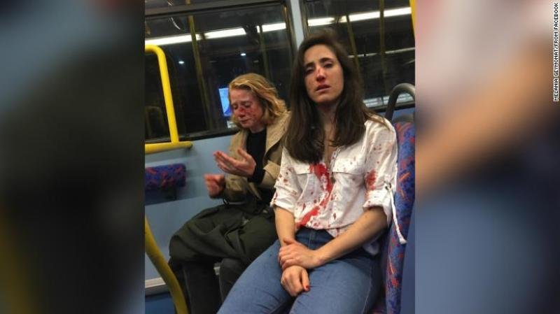 
<span>Se publica el vídeo de la paliza a una pareja de lesbianas en un autobús en Londres</span>
